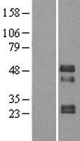 TOB2 Human Over-expression Lysates NM_016272