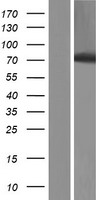HBS1L Human Over-expression Lysates NM_001145158