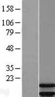 ARPP19 Human Over-expression Lysates NM_006628