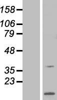 ls010777 arpp21 human over expression lysates nm 001025068 wb testing 2