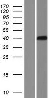 NEK6 Human Over-expression Lysates NM_001166167