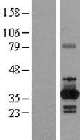 NEK6 Human Over-expression Lysates NM_001166168