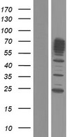 MSF (SEPT9) Human Over-expression Lysates NM_001113491