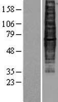 CCR9 Human Over-expression Lysates NM_006641