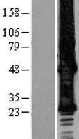 ls010804 gjb6 human over expression lysates nm 001110219 wb testing 1