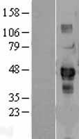 ENTR1 Human Over-expression Lysates NM_006643