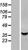 PCTP L (STARD10) Human Over-expression Lysates NM_006645