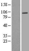 UTP14A Human Over-expression Lysates NM_006649