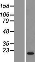 CPLX2 Human Over-expression Lysates NM_006650
