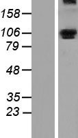 ALDH1L1 Human Over-expression Lysates NM_012190