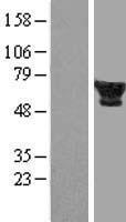 FTCD Human Over-expression Lysates NM_006657