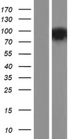 PDE10A Human Over-expression Lysates NM_006661