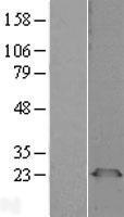PGRMC1 Human Over-expression Lysates NM_006667