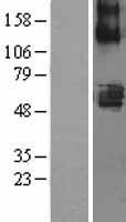 SLC22A7 Human Over-expression Lysates NM_006672