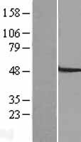 SLC22A7 Human Over-expression Lysates NM_153320