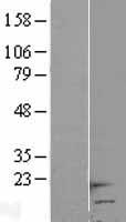 ls010866 hcp5 human over expression lysates nm 006674 wb testing 1