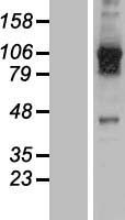 ls010868 usp20 human over expression lysates nm 001008563 wb testing 2