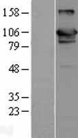 ls010868 usp20 human over expression lysates nm 006676 wb testing 1