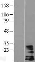 HCST Human Over-expression Lysates NM_001007469