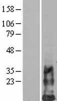 HCST Human Over-expression Lysates NM_014266