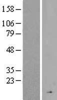 CFHR4 Human Over-expression Lysates NM_006684