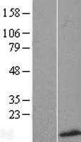 ls010879 smr3b human over expression lysates nm 006685 wb testing 1