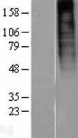 GPR73A (PROKR1) Human Over-expression Lysates NM_138964