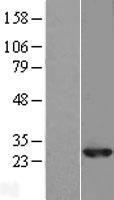 RAB10 Human Over-expression Lysates NM_016131