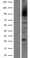 MALT1 Human Over-expression Lysates NM_173844