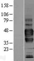 LYVE1 Human Over-expression Lysates NM_006691