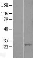 YIF1A Human Over-expression Lysates NM_020470