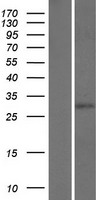 CPSF30 (CPSF4) Human Over-expression Lysates NM_006693