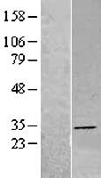 DHRS4 Human Over-expression Lysates NM_021004