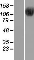 BRD8 Human Over-expression Lysates NM_139199
