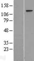 CA150 (TCERG1) Human Over-expression Lysates NM_001040006