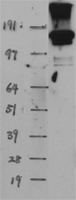 EHMT2/G9A (EHMT2) Human Over-expression Lysates NM_025256