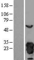 Peroxiredoxin 3 (PRDX3) Human Over-expression Lysates NM_006793
