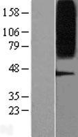 GPR75 Human Over-expression Lysates NM_006794