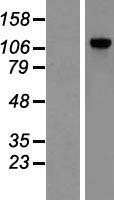POP1 Human Over-expression Lysates NM_015029