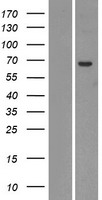 ls010941 ugt2a1 human over expression lysates nm 006798 wb testing 1
