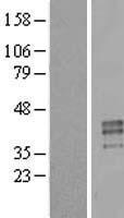 PRSS21 Human Over-expression Lysates NM_144956