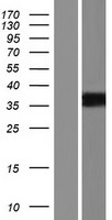 PRSS21 Human Over-expression Lysates NM_144957