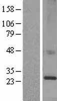 KDEL Receptor (KDELR1) Human Over-expression Lysates NM_006801