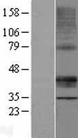 MLN64 (STARD3) Human Over-expression Lysates NM_001165937