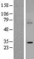 ls010950 btg3 human over expression lysates nm 006806 wb testing 1