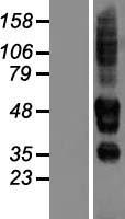 SERINC3 Human Over-expression Lysates NM_198941
