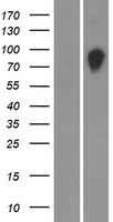 OS9 Human Over-expression Lysates NM_001017958