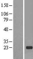 TMED2 Human Over-expression Lysates NM_006815