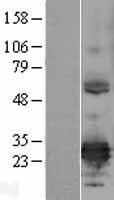 ERP29 Human Over-expression Lysates NM_006817
