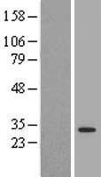 14-3-3 theta (YWHAQ) Human Over-expression Lysates NM_006826